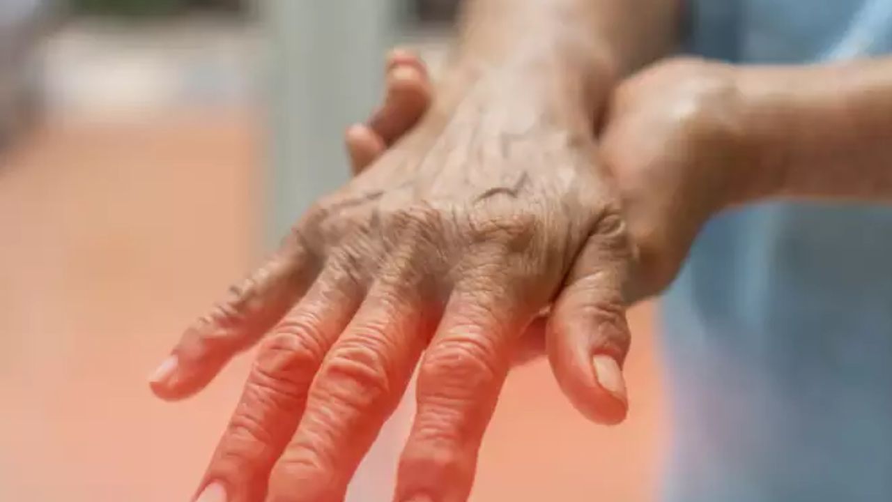 हातांमध्ये घाम येण्याचे कारण मज्जातंतू आहे. मज्जातंतू हे घाम येण्याच्या ग्रंथी एक्राइन जास्त सक्रीय करतात. त्यासाठी अॅप्पल सायडर व्हिनेगरमध्ये भिजवा. यामुळे पीएच संतुलित करते आणि जास्त घाम कमी करते.
