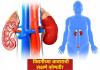 कोणत्या देशांमध्ये किडनीच्या आजाराचे सर्वाधिक रुग्ण? जाणून घ्या