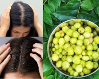 हिवाळ्यात केसातील कोंडा कमी करण्यासाठी हे नैसर्गिक डिटॉक्स पेय दररोज प्यायलाच हवे