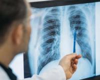 फुफ्फुसाचं आरोग्य राखण्यासाठी आहारात ‘या’ पदार्थांचा करा समावेश