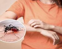 ‘या’ सोप्या उपायांचा अवलंब केल्यास मुलांच्या जवळही फिरकणार नाही डास