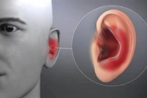 बदलत्या ऋतूमध्ये कानाचं इंफेक्शन होऊ नये म्हणून नेमकं काय करावे?