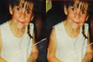 निसर्गाचा अजब खेळ, लहानपणीच चिमुकलीला आलं म्हातारपण, ‘या’ प्रकरणात असं होणं शक्य